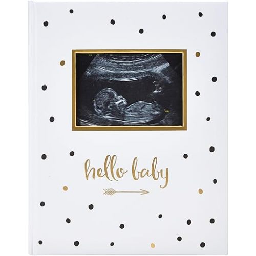 Pearhead Hello Baby First 5 Years Memory Book, Gender-Neutral Baby Keepsake for New and Expectant Parents, Pregnancy And Milestone Journal, Modern Minimalist Black and Gold Polka Dot