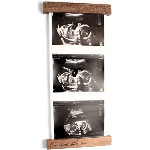 Live Sonogram Frame in Walnut - Magnetic Refrigerator Frame for Baby Ultrasound Photos