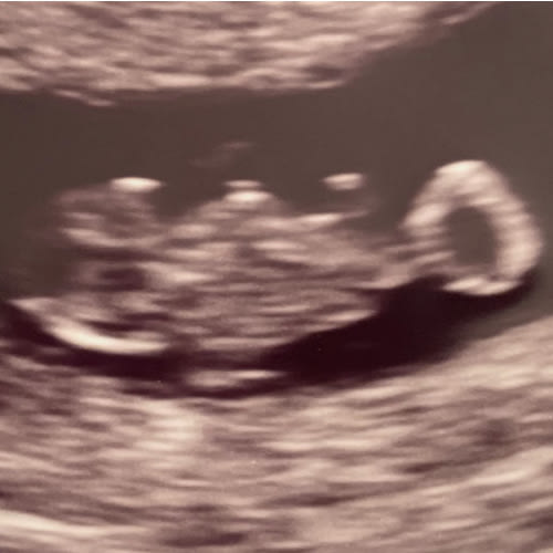 Amazon Baby Registry
