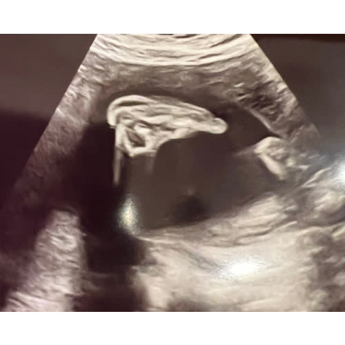 Babylist Cash Fund