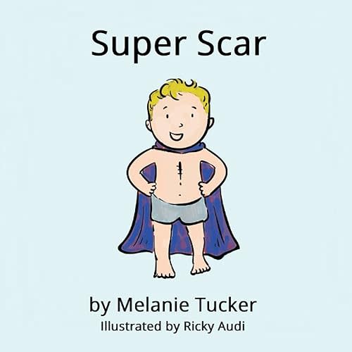 Super Scar Paperback