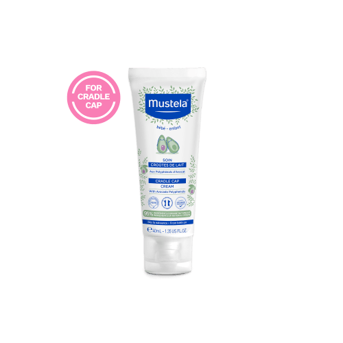 Cradle cap cream