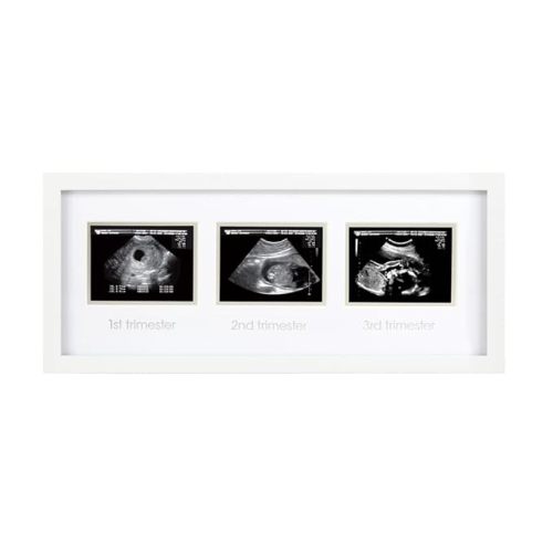 Pearhead Sonogram Progression Frame - Trimester by Trimester Pregnancy Milestone Keepsake, Gender-Neutral Nursery Decor, Displays 1st, 2nd & 3rd Trimester Ultrasound Photos, White