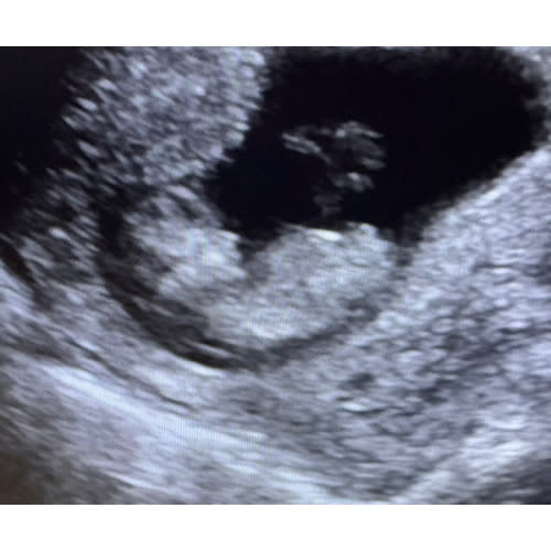 Claribell’s Maternity Leave Fund