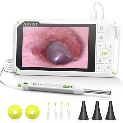 Anykit Digital Otoscope with Gyroscope, 4 Inches Screen, 3.9mm Ear Scope Camera with 6 Lights, Ear Wax Removal Tool, 32GB Card, Supports Photo Snap and Video Recording