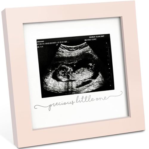 KeaBabies Baby Sonogram Picture Frame - Modern Ultrasound Picture Frames for Mom to Be, First Pregnancy Gifts for Expecting Mom & First Time Dad, Baby Gender Reveal Gifts (Petal Pink)