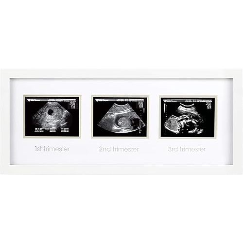 Pearhead Sonogram Progression Frame - Trimester by Trimester Pregnancy Milestone Keepsake, Gender-Neutral Nursery Decor, Displays 1st, 2nd & 3rd Trimester Ultrasound Photos, White
