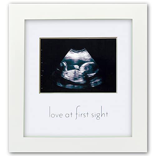 Green Pollywog Sonogram Photo Display | White Ultrasound Frame | Pregnancy Gift for First-Time Moms, Parents & Grandparents | Nursery Decor
