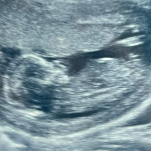 Baby Girard’s savings account!