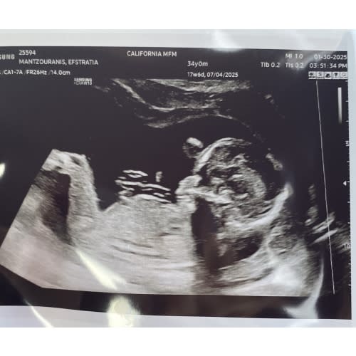 Fund to help provide me with postpartum care