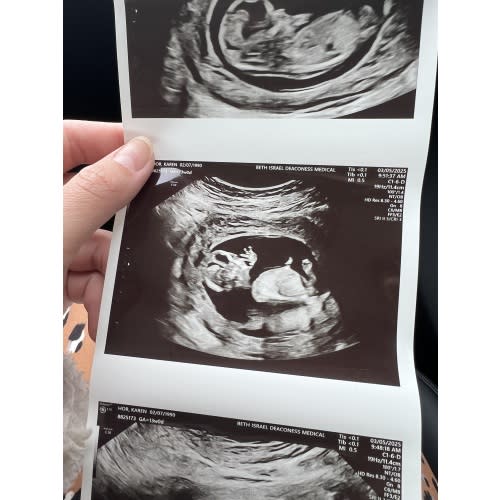 Baby Fund