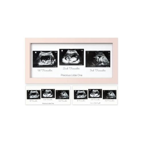 Trio Baby Sonogram Frame