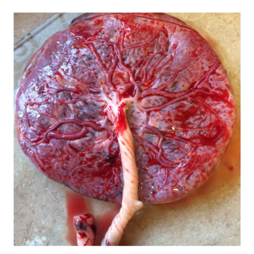 Placenta encapsulation Miami— Aixa Amankay