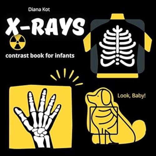 X-RAYS, contrast book for infants | Rhyming verses: Black and white book, baby contrast book, Educational book for children ages 0-3, X-ray