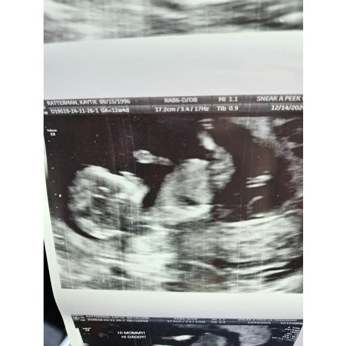 Parental Leave/Daycare Fund