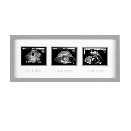 Pearhead Triple Sonogram Picture Frame, Pregnancy Keepsake Photo Frame, Gender-Neutral Baby Nursery Décor, Baby Accessory for New and Expecting Parents, Gray