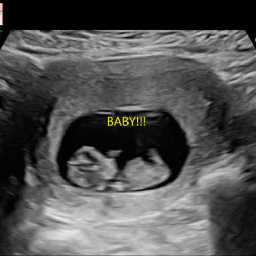 Baby and Ayush Parashar’s Baby Registry at Babylist