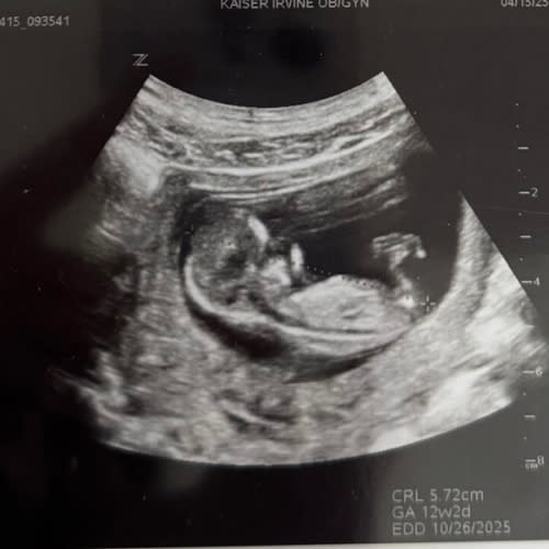 Baby Wes Fund