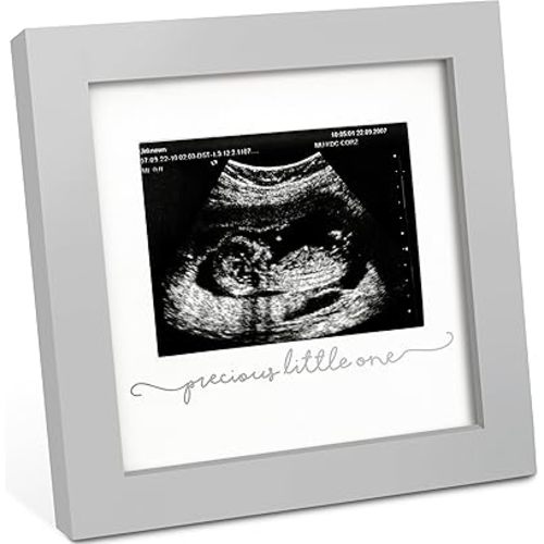 KeaBabies Baby Sonogram Picture Frame - Modern Ultrasound Picture Frames for Mom to Be, First Pregnancy Gifts for Expecting Mom & First Time Dad, Baby Gender Reveal Gifts(Cloud Gray)