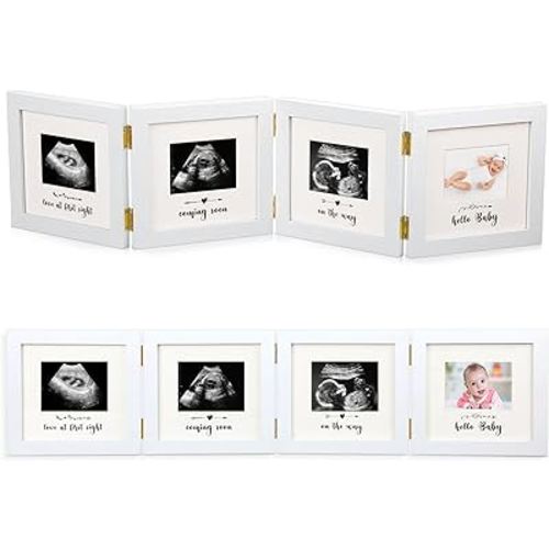 Beeveer Sonogram Picture Frame Quadruple Ultrasound Picture Frame 4 Folding Pregnancy Keepsake Photo Frame for Pregnancy Announcements First Time to Be Dad Mom Gifts Gender Neutral Baby Nursery Décor