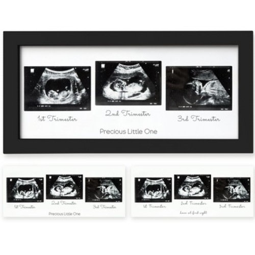 KeaBabies Trio Baby Sonogram Picture Frame, Baby Ultrasound Picture Frames for Baby Nursery, Mom to Be Gifts, Color: Onyx black