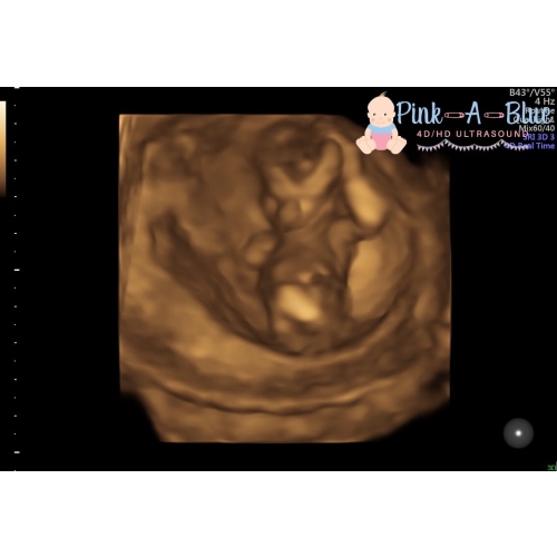 newborn photo fund