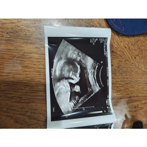 Stroller, Car Seat, & Gear Fund