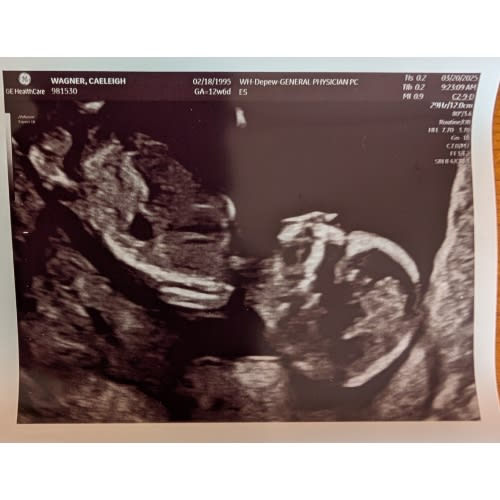 Maternity Leave Fund