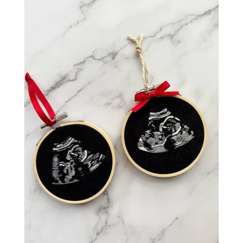 Custom Ultrasound Embroidery Personalized Christmas Ornament - Etsy