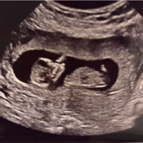 Babylist Cash Fund
