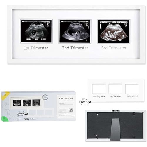 BabySquad Trimester Ultrasound and Sonogram Progression Photo Frame, EXTRA LARGE SIZE, Shatter Resistant Tempered Glass,16.5 x 6.5 INCHES, Bonus Matte Insert, Sawtooth Hanger + Kickstand Stand