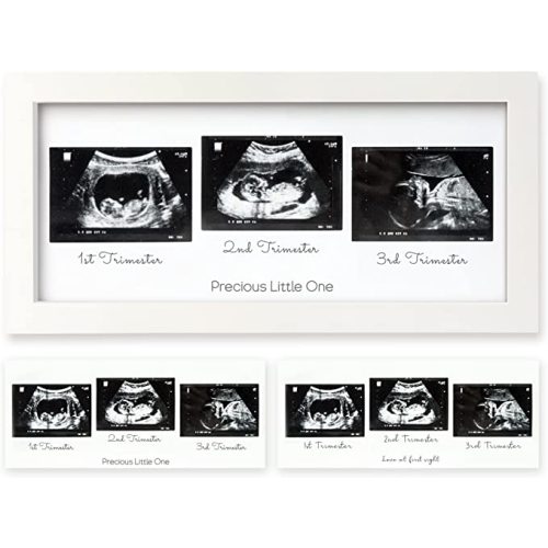 Sonogram Picture Frame - Trio Ultrasound Picture Frames For Mom To Be Gift - Baby Ultrasound frame - Pregnancy Announcements Sonogram frame - Baby Nursery Decor, Pregnant Mom Gifts (Alpine White)