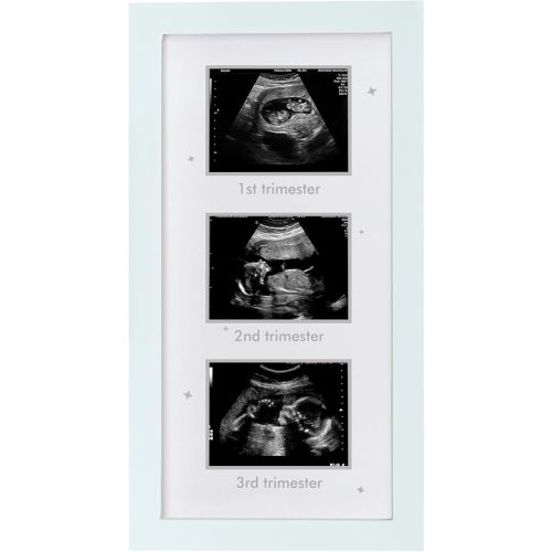 Ultrasound Picture Frame - Triple Sonogram Frame for Mom to Be | Pregnancy Photo Album Decor | Baby Nursery Essentials & Gender Reveal Gifts | First Trimester Keepsake & Pregnancy Must Haves - White2