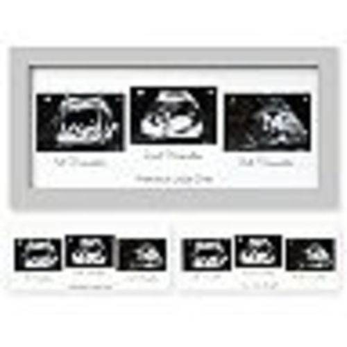 KeaBabies Trio Baby Sonogram Picture Frame, Baby Ultrasound Picture Frames for New Mom, Baby Nursery