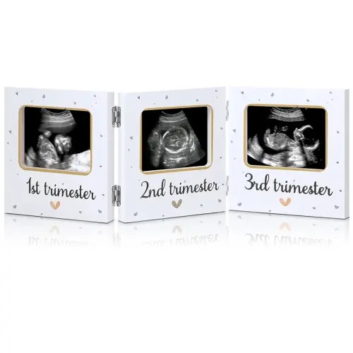 Amyhill Triple Ultrasound Picture Frames, Baby Sonogram Photo Frame Pregnancy Ultrasound Keepsake Frame, Gift for Expecting Parents, Baby Shower Nursery Decor, White