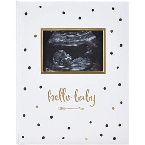 Pearhead Hello Baby First 5 Years Memory Book, Gender-Neutral Baby Keepsake for New and Expecting Parents, Pregnancy And Milestone Journal, Modern Minimalist Black and Gold Polka Dot