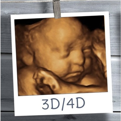 3D/4D/HD ultrasound $160