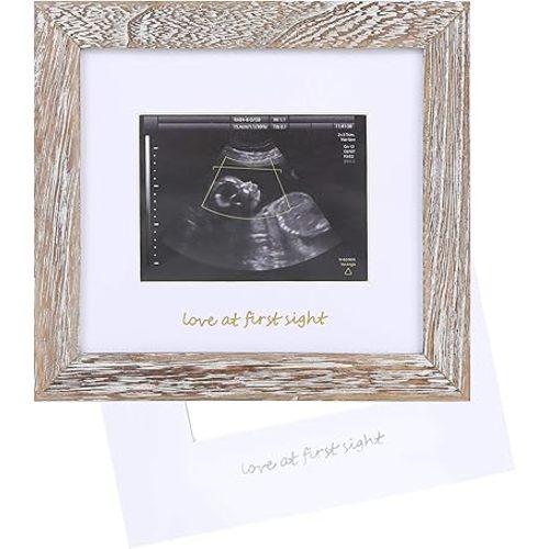IHEIPYE Baby Love at First Sight Sonogram Keepsake Frame - Ultrasound Picture Frame - Pregnancy Announcement Frame for Expecting Parents, Gender Reveal Party, Grandparents, Rustic White