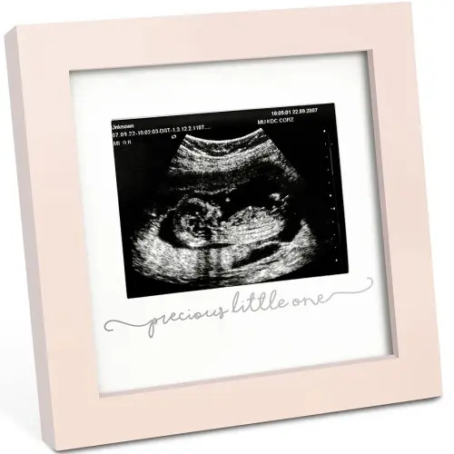 KeaBabies Baby Sonogram Picture Frame - Modern Ultrasound Picture Frames for Mom to Be, First Pregnancy Gifts for Expecting Mom & First Time Dad, Baby Gender Reveal Gifts (Petal Pink)