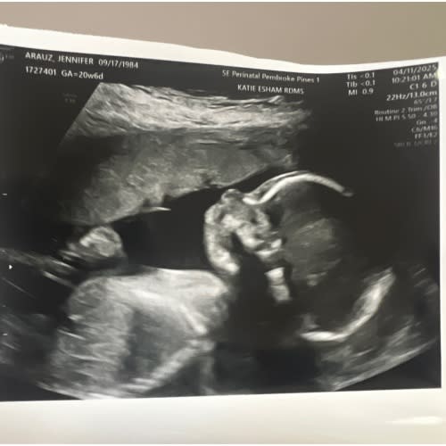 Surrogacy Fund!