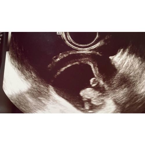 Go Fund Me: Baby J’s second parent adoption fees