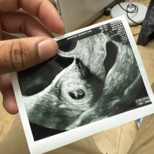 Babylist Babymoon Fund