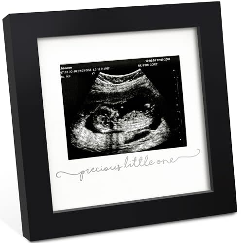 KeaBabies Baby Sonogram Picture Frame - Modern Ultrasound Picture Frames for Mom to Be, First Pregnancy Gifts for Expecting Mom & First Time Dad, Baby Gender Reveal Gifts (Onyx Black)