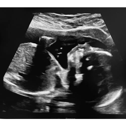 Baby Vittorio Cash Fund