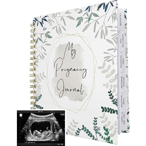 Pregnancy Journal Memory Book for Expecting Moms - Calendar for Pregnancy Planner - Weekly Monthly Organizer to Track Milestones - Hardcover with Keepsake Pocket - Gift for First Time Moms