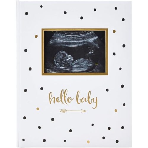 Pearhead Hello Baby First 5 Years Memory Book, Gender-Neutral Baby Keepsake for New and Expectant Parents, Pregnancy And Milestone Journal, Modern Minimalist Black and Gold Polka Dot