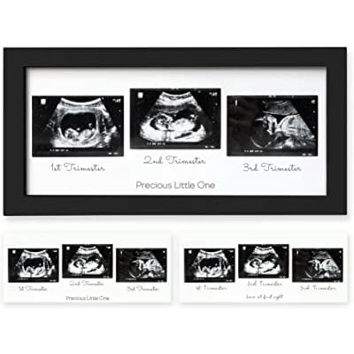 Amazon.com: Sonogram Picture Frame - Trio Ultrasound Picture Frames For Mom To Be Gift - Baby Ultrasound frame - Pregnancy Announcements Sonogram frame - Baby Nursery Decor, Pregnant Mom Gifts (Onyx Black) : Baby