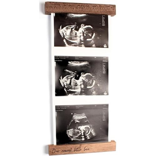 Live Sonogram Frame in Walnut - Magnetic Refrigerator Frame for Baby Ultrasound Photos