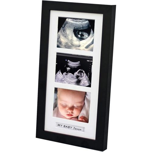 Triple Ultrasound Picture Frames, Sonogram Picture Frame 3 Photos,Pregnancy Announcements,Pregnancy Gifts for First Time Moms,First Time Mom Gift,Black,Ultrasound Photo Album