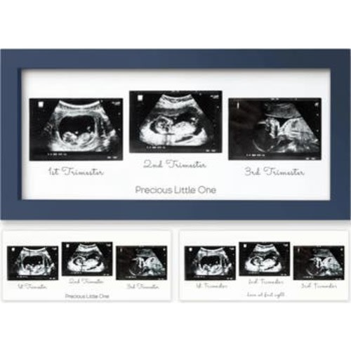 Trio Baby Sonogram Frame